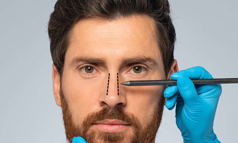 reconstruction_nez